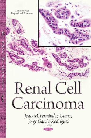 Renal Cell Carcinoma