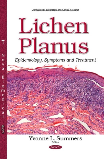 Book cover of: Lichen Planus. By: Yvonne L. Summers