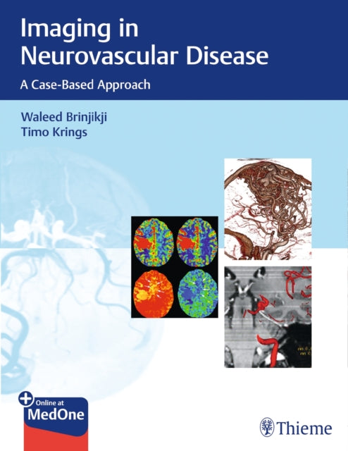 Book cover of: Imaging in Neurovascular Disease. By: Waleed Brinjikji