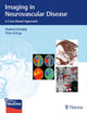 Book cover of: Imaging in Neurovascular Disease. By: Waleed Brinjikji