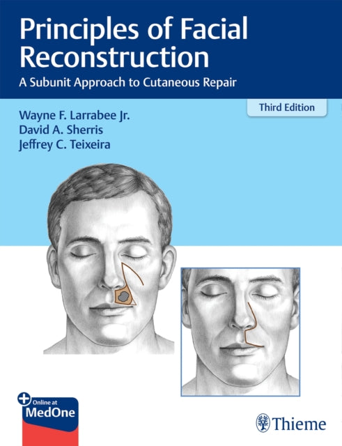 Book cover of: Principles of Facial Reconstruction. By: Wayne F. Larrabee