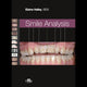 Book cover of: Smile Analysis. By: Elaine Halley