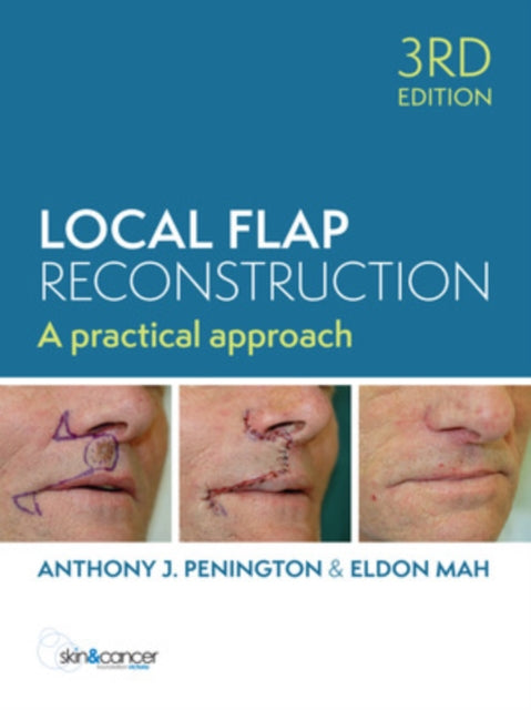 Book cover of: Local Flap Reconstruction. By: Anthony Penington
