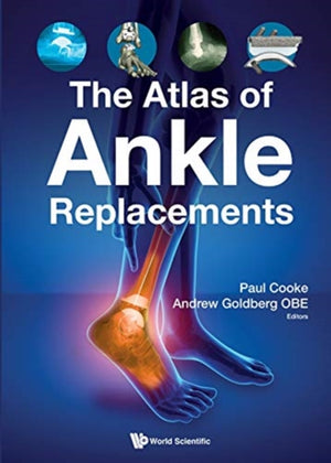 Atlas of Ankle Replacements