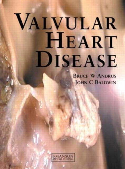 Book cover of: Valvular Heart Disease