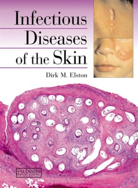 Book cover of: Infectious Diseases of the Skin