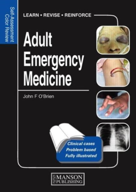 Book cover of: Adult Emergency Medicine. By: John T. O'Brien