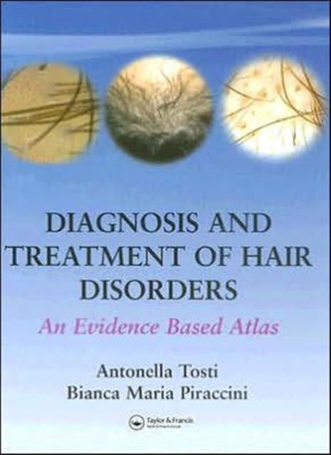 Book cover of: Diagnosis and Treatment of Hair Disorders. By: Antonella Tosti