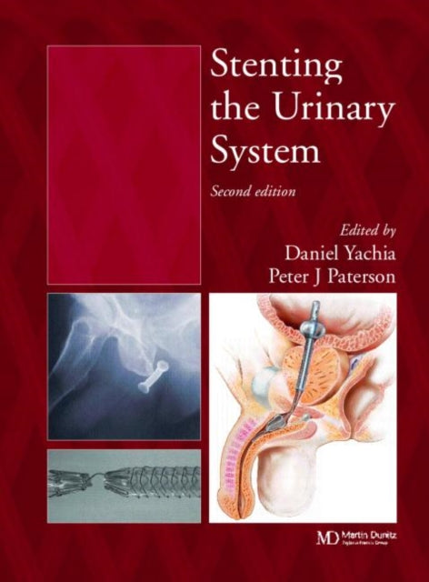 Book cover of: Stenting the Urinary System