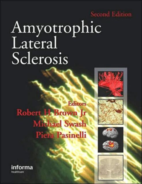 Book cover of: Amyotrophic Lateral Sclerosis, Second Edition
