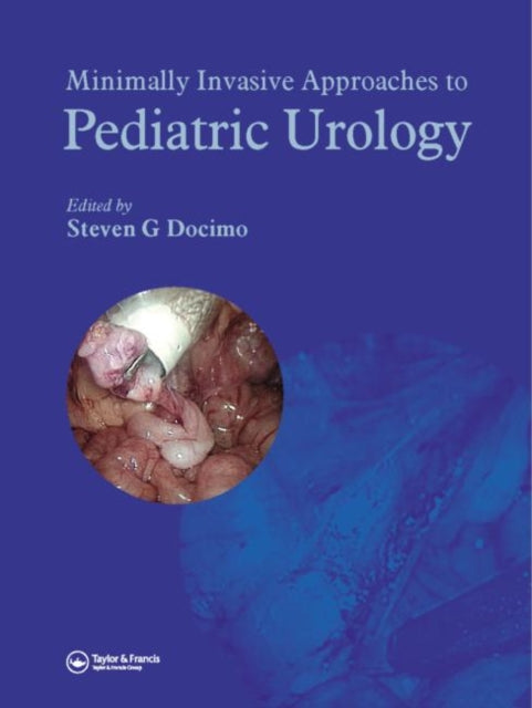 Book cover of: Minimally Invasive Approaches to Pediatric Urology. By: Steven G. Docimo