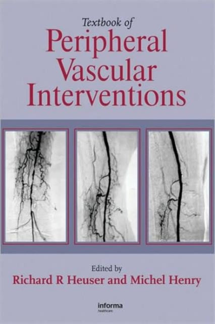Book cover of: Textbook of Peripheral Vascular Interventions