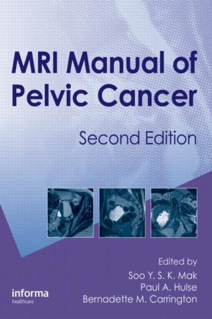 Book cover of: MRI Manual of Pelvic Cancer. By: Soo Y. S. K. Mak