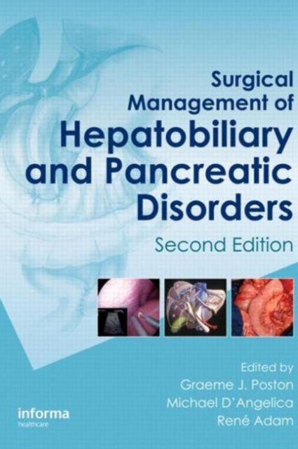 Book cover of: Surgical Management of Hepatobiliary and Pancreatic Disorders, Second Edition. By: Graeme J. Poston