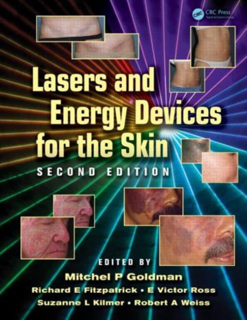 Book cover of: Lasers and Energy Devices for the Skin