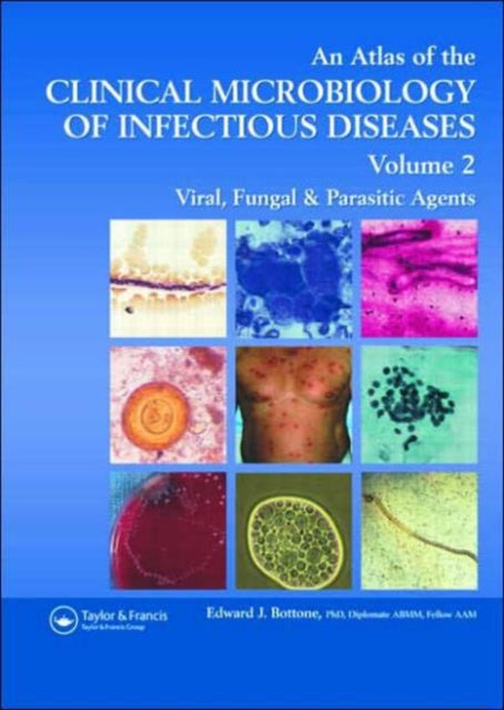 Book cover of: Atlas of the Clinical Microbiology of Infectious Diseases. By: Edward J. Bottone