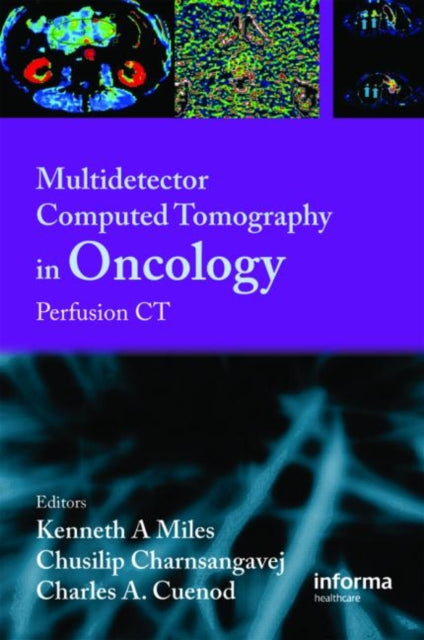 Book cover of: Multi-Detector Computed Tomography in Oncology
