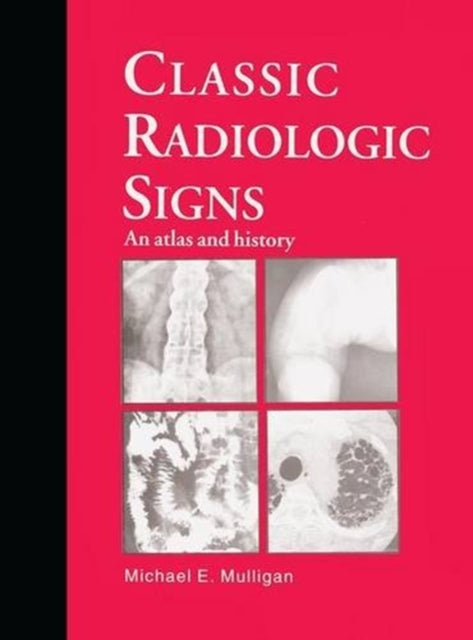 Book cover of: Classic Radiologic Signs. By: M.E. Mulligan