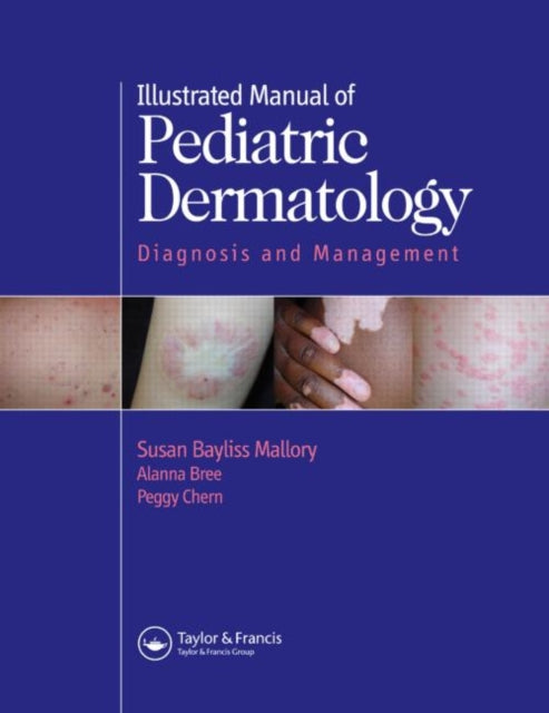 Book cover of: Illustrated Manual of Pediatric Dermatology. By: Susan B. Mallory