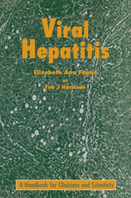 Book cover of: Viral Hepatitis. By: E A FAGAN
