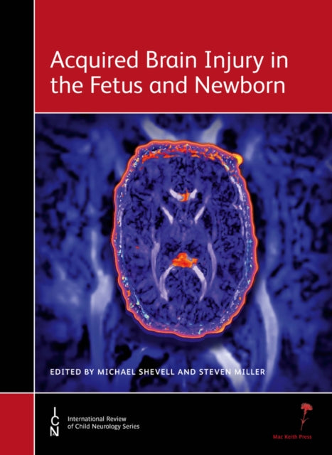 Book cover of: Acquired Brain Injury in the Fetus and Newborn