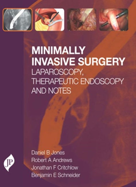 Minimally Invasive Surgery