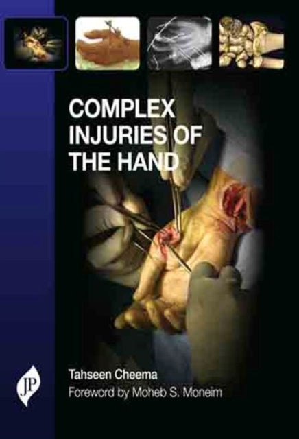 Book cover of: Complex Injuries of the Hand. By: Tahseen Cheema