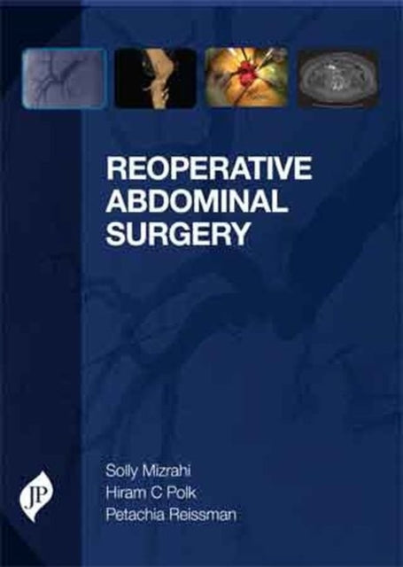 Book cover of: Reoperative Abdominal Surgery. By: Solly Mizrahi