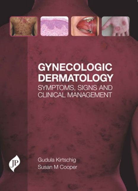 Gynecologic Dermatology