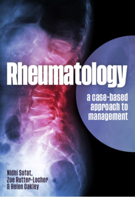 Book cover of: Rheumatology. By: Nidhi Sofat