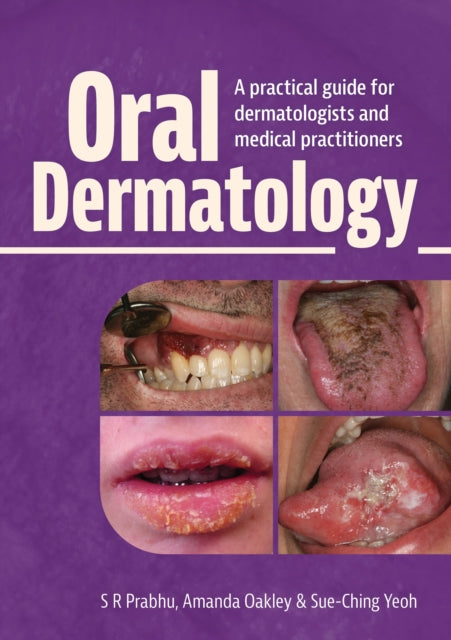 Book cover of: Oral Dermatology. By: S. R. Prabhu