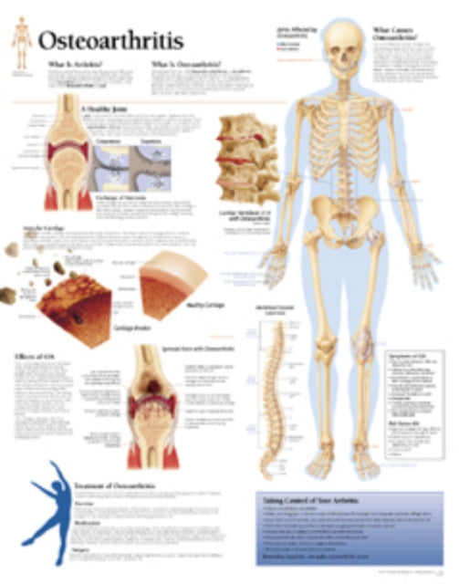 Book cover of: Osteoarthritis Laminated Poster. By: Scientific Publishing
