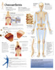 Book cover of: Osteoarthritis Laminated Poster. By: Scientific Publishing