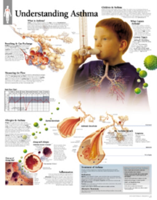 Book cover of: Understanding Asthma Paper Poster. By: Scientific Publishing