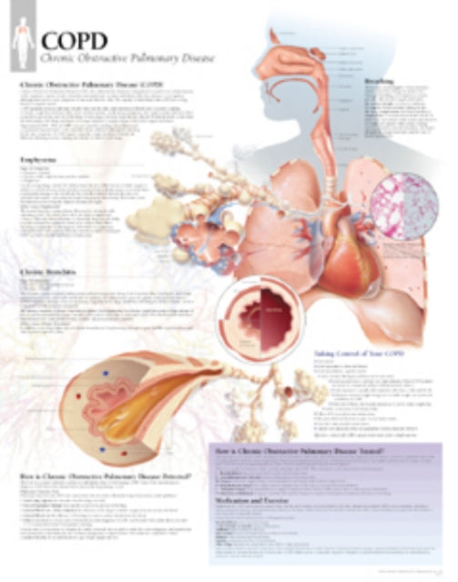 Book cover of: COPD (Chronic Obstructive Pulmonary Disease) Laminated Poster. By: Scientific Publishing
