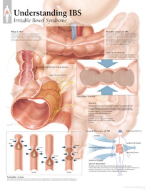 Book cover of: Understanding IBS Laminated Poster. By: Scientific Publishing