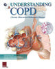 Book cover of: Understanding COPD Flip Chart. By: Scientific Publishing Ltd.