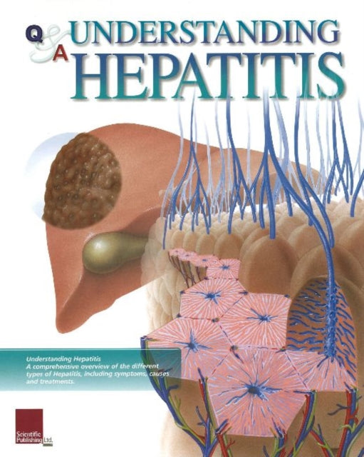 Book cover of: Understanding Hepatitis Flip Chart. By: Scientific Publishing Ltd.