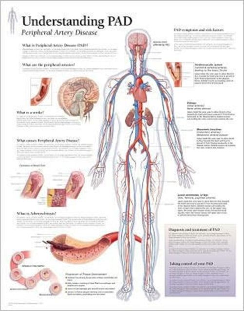 Book cover of: Understanding PAD Paper Poster