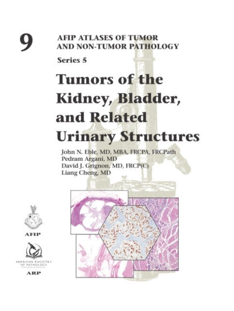 Book cover of: Tumors of the Kidney, Bladder, and Related Urinary Structures. By: John Eble