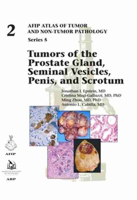 Book cover of: Tumors of the Prostate Gland, Seminal Vesicles, Penis, and Scrotum. By: Jonathan I. Epstein