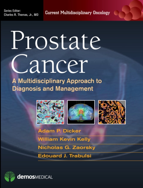 Book cover of: Prostate Cancer. By: Adam P. Dicker