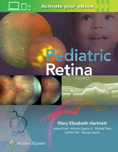 Book cover of: Pediatric Retina. By: Mary Elizabeth Hartnett