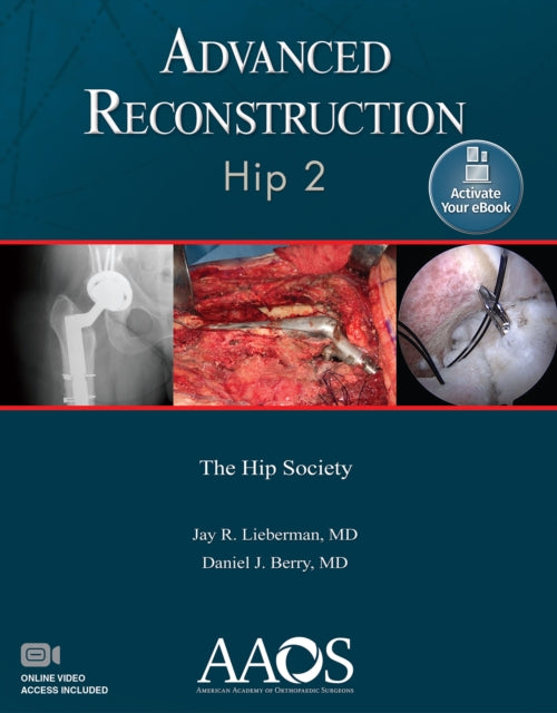 Book cover of: Advanced Reconstruction: Hip 2: Print + Ebook with Multimedia. By: Jay R. Lieberman M.D.