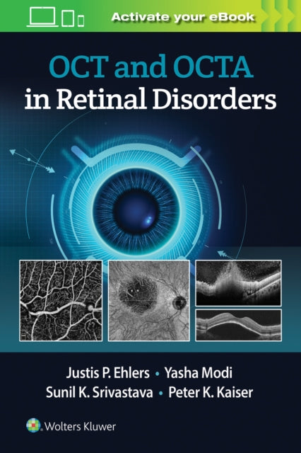 Book cover of: OCT and OCTA in Retinal Disorders. By: EHLERS