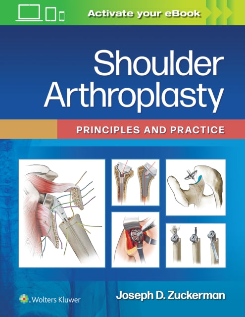 Book cover of: Shoulder Arthroplasty. By: Joseph D. Zuckerman