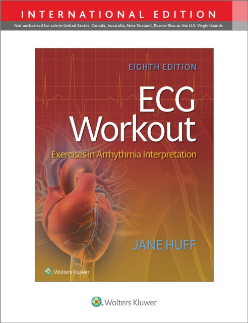 Book cover of: ECG Workout. By: HUFF