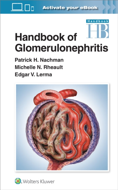 Book cover of: Handbook of Glomerulonephritis. By: Patrick Nachman