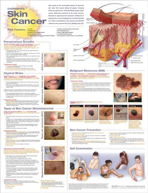 Book cover of: Understanding Skin Cancer Anatomical Chart