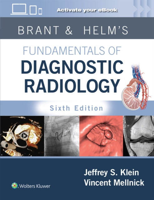 Book cover of: Brant & Helms' Fundamentals of Diagnostic Radiology: Print + eBook with Multimedia. By: Jeffrey Klein